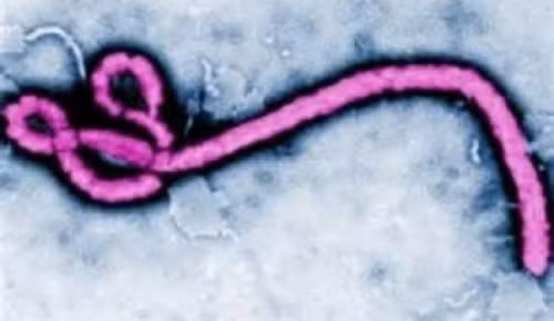 WHO chấp thuận phương pháp xét nghiệm nhanh virus Ebola ảnh 1