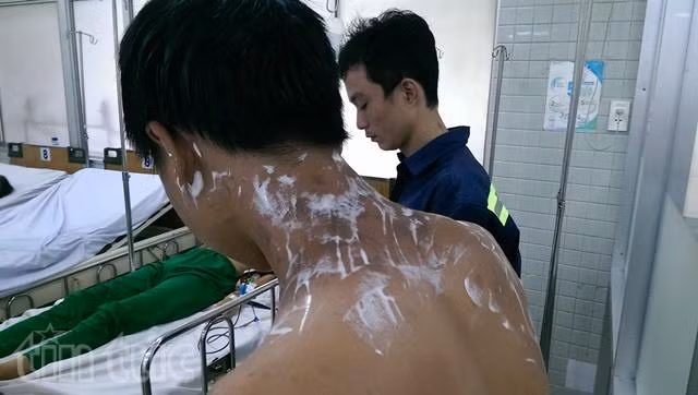 Nổ hoá chất ở chợ "tử thần" Kim Biên, 4 người bị bỏng ảnh 2