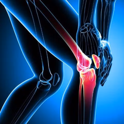 Thoái hóa khớp gối ngày càng 'tấn công' người trẻ tuổi ảnh 1