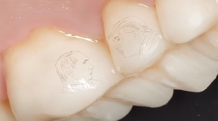 Rộ mốt ‘xăm” mặt Tổng thống Putin – Trump lên răng ở Nga ảnh 1
