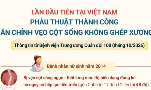 Phẫu thuật thành công nắn chỉnh vẹo cột sống không ghép xương