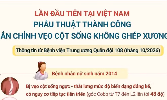 Phẫu thuật thành công nắn chỉnh vẹo cột sống không ghép xương