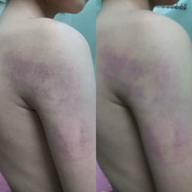 Vụ học sinh lớp 1 bị giáo viên đánh ở Hà Nội: Không phải lần đầu cô giáo này dùng bạo lực ảnh 1