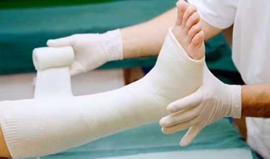 Mùa hè gia tăng trẻ bị thương tích, chăm sóc trẻ bó bột tại nhà như thế nào? ảnh 1