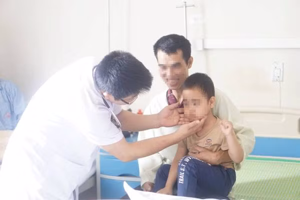 Bé 5 tuổi mọc rậm lông mặt, suy thượng thận do dùng thuốc Corticoid không đúng chỉ định ảnh 1