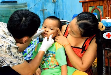Phát hiện sớm để giảm tử vong vì bệnh tay chân miệng ảnh 1
