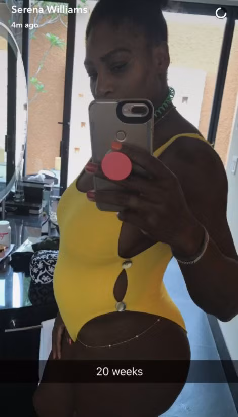 Serena Williams bất ngờ úp mở đang mang thai ảnh 1