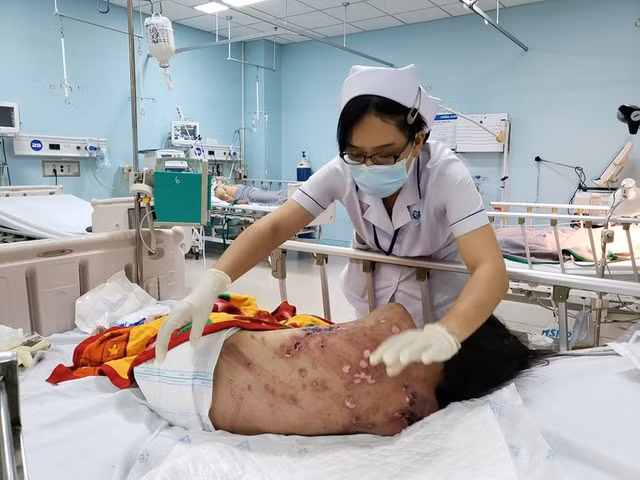 Chú thích ảnh