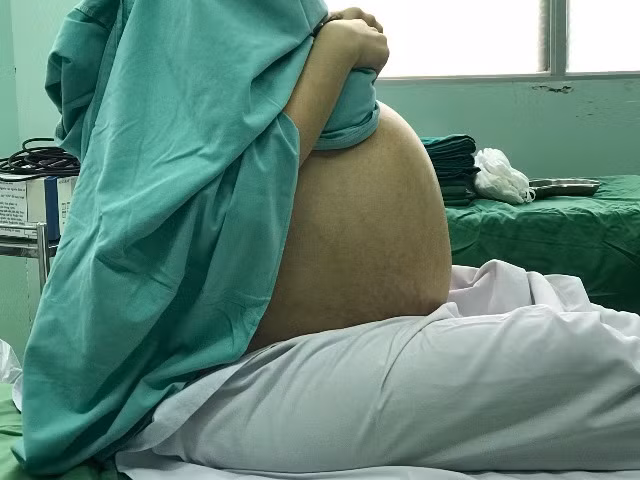  Người phụ nữ có khối u buồng trứng to hơn bụng của thai phụ chuẩn bị sinh ảnh 1