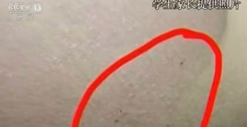 Trung Quốc rúng động trước cáo buộc trường mẫu giáo bạo hành trẻ em bằng kim tiêm ảnh 2