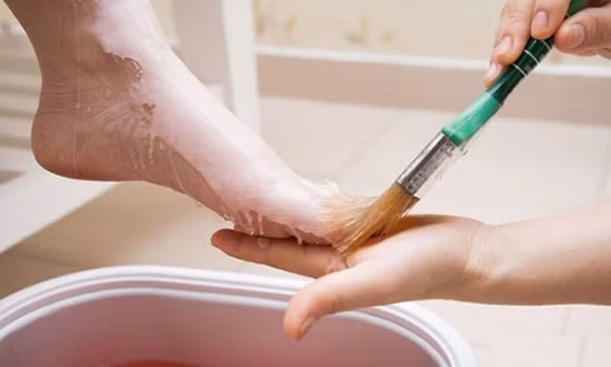Đắp Paraphin điều trị giảm đau ảnh 1