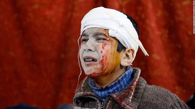 Xót xa cảnh người Syria mắc kẹt trong 'tử địa' Đông Ghouta sau cơn mưa bom ảnh 6