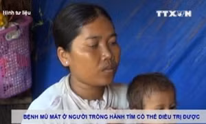 Bệnh mù mắt ở người trồng hành tím có thể điều trị được