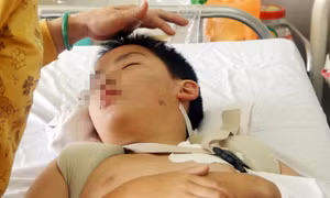 Một nạn nhân vụ rơi tàu lượn chuyển viện