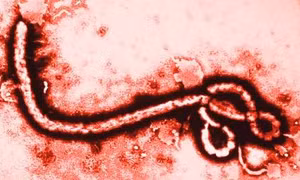 Tìm ra 'gót chân Achilles' của virus Ebola 