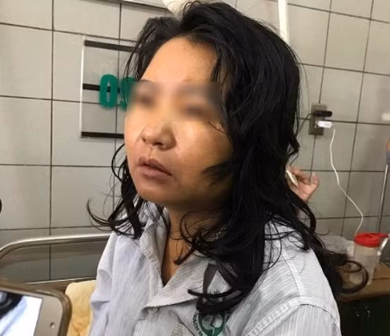 Hôn mê, nguy kịch vì thực phẩm chức năng giảm cân? ảnh 1