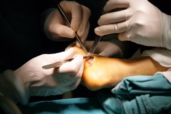 Xoa dịu nỗi đau cho những trẻ khuyết tật vận động ảnh 2