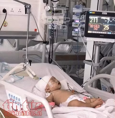 Bé gái 14 tháng tuổi bị khỉ cắn rách đầu ảnh 1