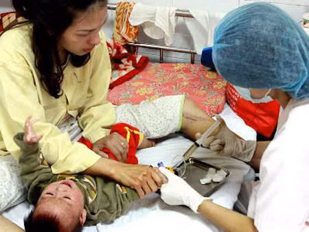 Dịch sởi vẫn xuất hiện rải rác tại Yên Bái ảnh 1