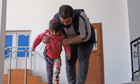 Bé gái 7 tuổi Salwa al Raslan, ở tỉnh Idlib, Syria, bị mất chân trái do giẫm phải mìn, được lắp chân giả in 3D. Ảnh: El Pais