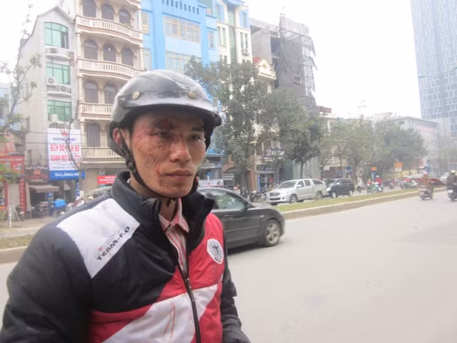 Khách đi xe buýt bị 'nhà xe' đánh trọng thương ảnh 2