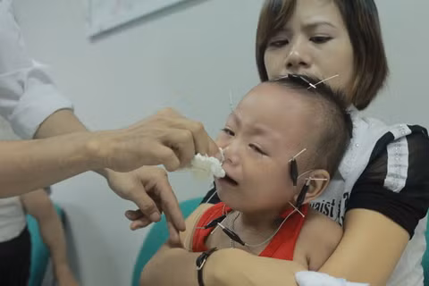 "Thần" châm cứu và những bệnh nhi ảnh 8