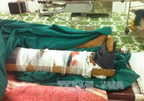 Ngư dân nguy kịch do tai nạn máy tời trên đảo Bạch Long Vĩ ảnh 1