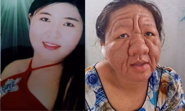 Dễ trở thành 'cụ bà' vì mỹ phẩm gia công kém chất lượng ảnh 4