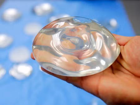 Phát hiện ung thư vú do nâng ngực bằng silicone ảnh 1