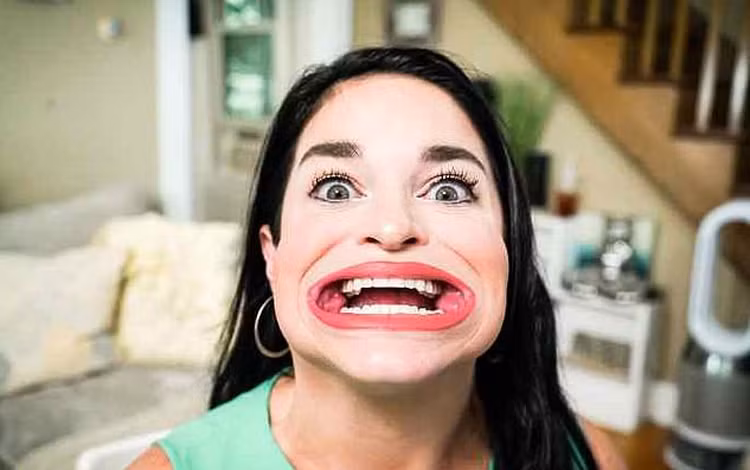 Cô gái lập kỷ lục miệng rộng nhất thế giới