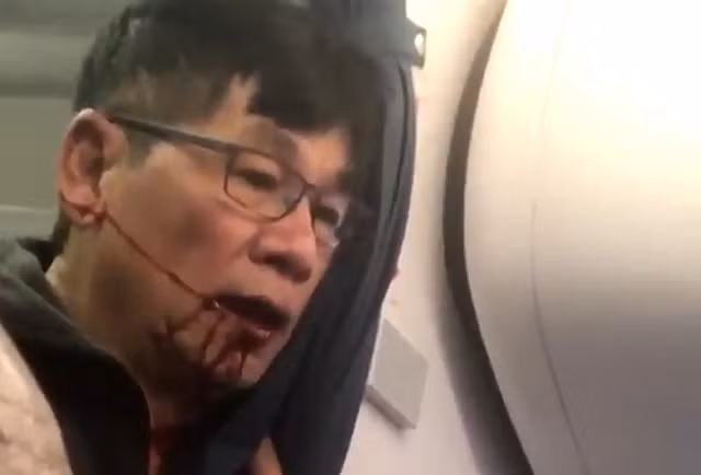 United Airlines 'trắng án' vụ hành khách gốc Việt bị đấm chảy máu mồm ảnh 1