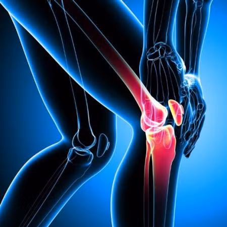 Tập thể dục không đúng cách gây thoái hóa khớp sớm với người trẻ ảnh 2