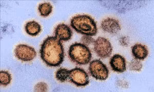Phát hiện virus SARS-CoV-2 trong tinh dịch bệnh nhân nam