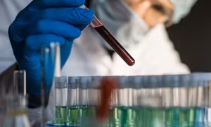 California ghi nhận ca mắc bệnh dịch hạch đầu tiên kể từ năm 2015