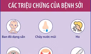 Các triệu chứng của bệnh sởi