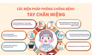 Các biện pháp phòng chống bệnh tay chân miệng