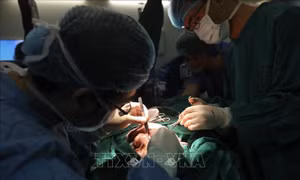Phẫu thuật cắt bỏ khối u lớn trên mặt bệnh nhân 52 tuổi