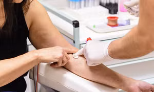 Phương pháp tầm soát ung thư phổi chỉ cần xét nghiệm máu đơn giản