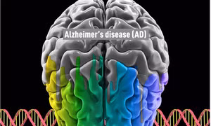 Phát hiện về cơ chế trong não bộ thúc đẩy bệnh Alzheimer