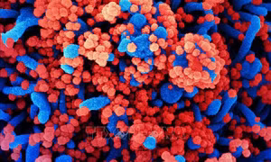 Nghiên cứu cơ chế virus SARS-CoV-2 gây cục máu đông