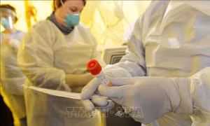 FDA cho phép sử dụng xét nghiệm kháng nguyên virus SARS-CoV-2 đầu tiên