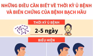Những điều cần biết về thời kỳ ủ bệnh và biến chứng của bệnh bạch hầu