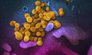 Cảnh báo khả năng các biến thể tương lai của virus SARS-CoV-2 né được phản ứng của tế bào T