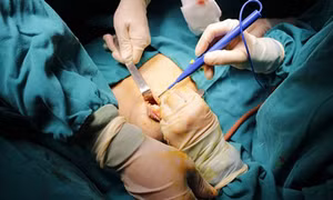  Cứu sống thai phụ bị viêm ruột thừa sắp vỡ và có triệu chứng sinh non