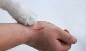 Đắk Lắk tăng cường giám sát ổ dịch dại trên người 