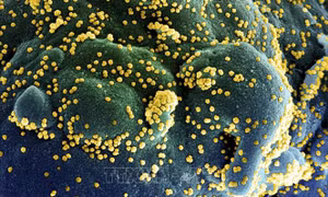 Nghiên cứu mới: Hoạt chất chiết xuất từ tinh dầu khuynh diệp có thể tiêu diệt virus SARS-CoV-2