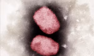 Virus gây bệnh đậu mùa khỉ ở Bồ Đào Nha ít lây lan hơn