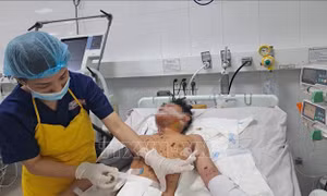 Cảnh báo mức độ nguy hiểm của pháo nổ