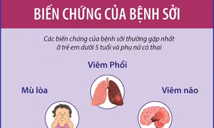 Biến chứng của bệnh sởi