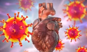 Cảnh báo virus cảm cúm thông thường cũng có thể gây viêm cơ tim nguy hiểm